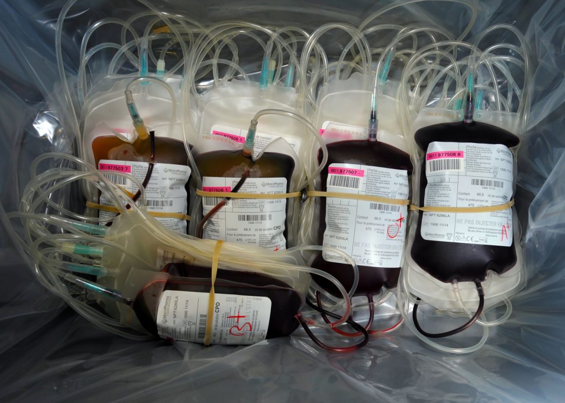 Nove Hospitais do SNS vão Avançar com Projetos de Redução de Transfusões de Sangue Nove Hospitais do SNS vão Avançar com Projetos de Redução de Transfusões de Sangue